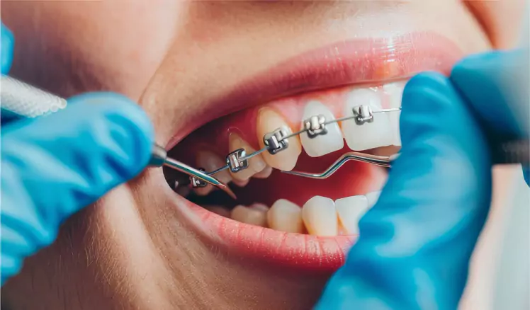 Dental technology
