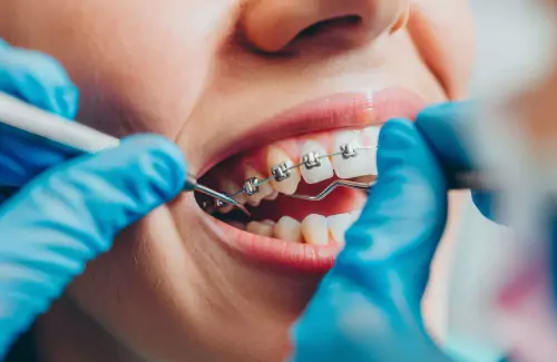 Dental blog