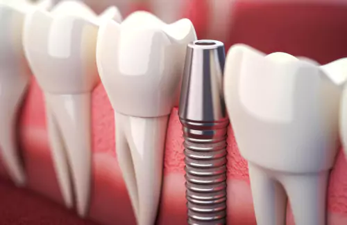 Dental technology