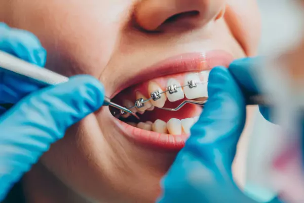 Orthodontics